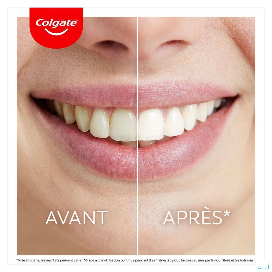 Colgate Max White Led Whitening Kit 2 Prod.
