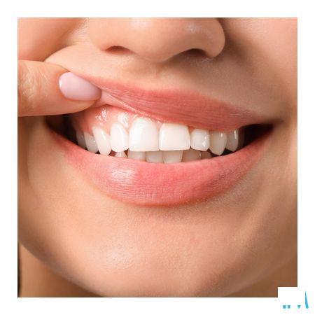 Vitis Gingival Tandenborstel 1 2872  -  Dentaid