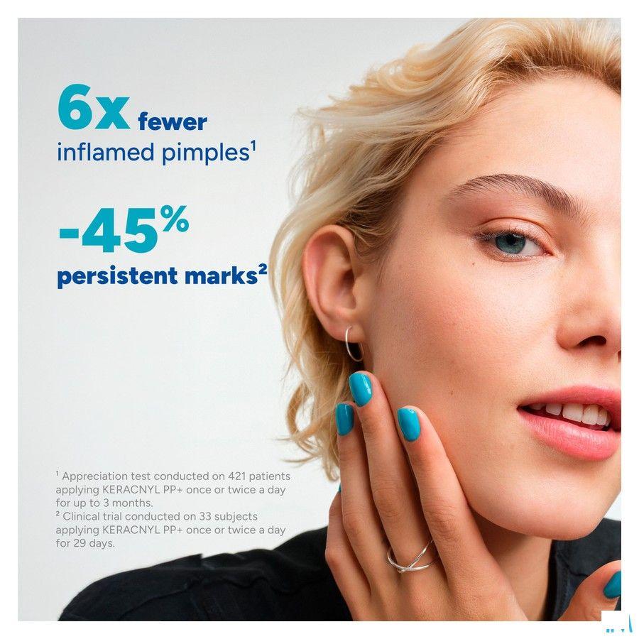 Ducray Keracnyl Pp + Creme 30 ml  -  Ducray Benelux