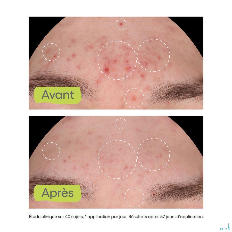 Aderma Biology Ac Night Peel Serum A/Imperf. 30 ml