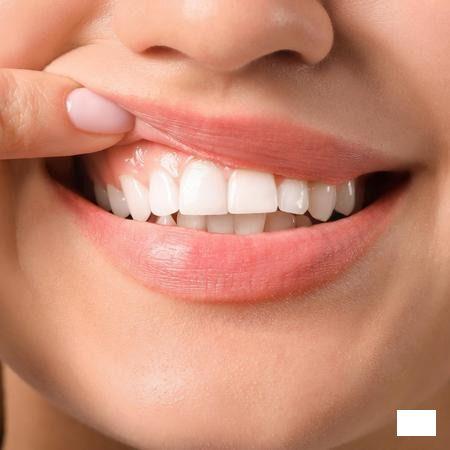 Vitis Gingival Tandenborstel 1 2872  -  Dentaid