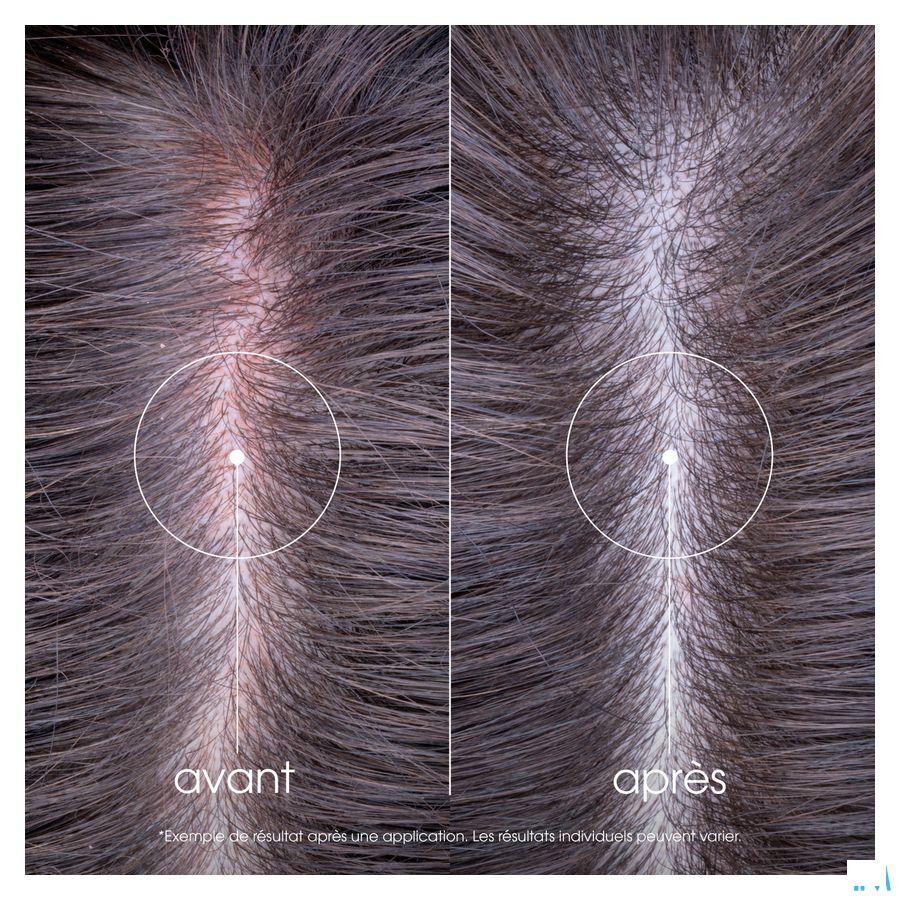 Klorane Capil. Shampooing Pivoine Bio 100 ml