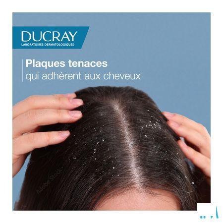 Ducray Kelual Squanorm Shampoo Vette Schilfers 400 ml