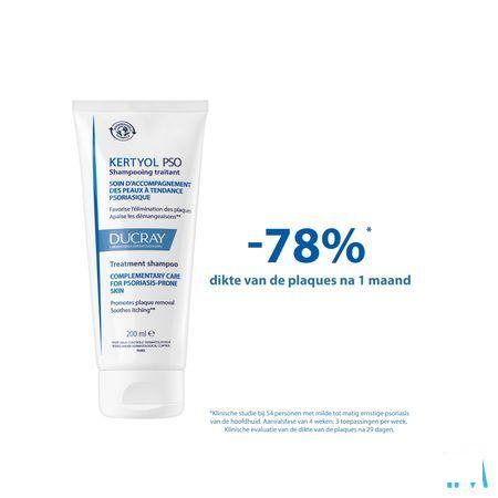 Ducray Kertyol Pso Shampoo 200 ml