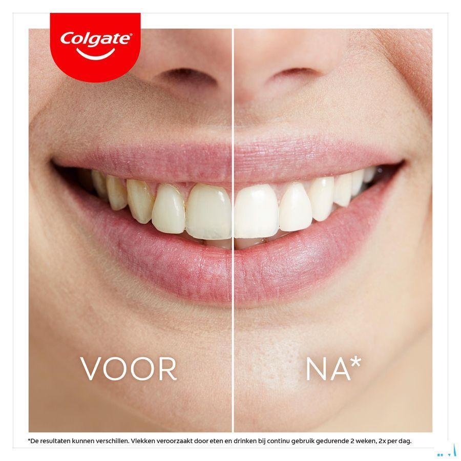 Colgate Max White Led Whitening Kit 2 Prod.