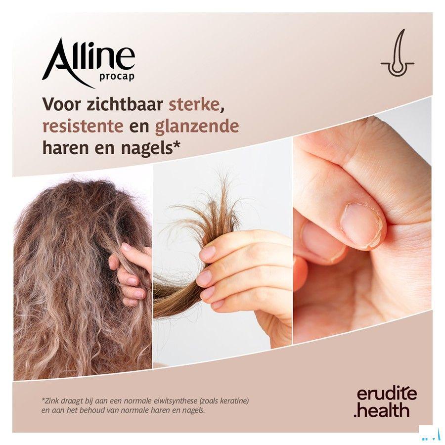 Alline Procap Capsule 30  -  Trenker