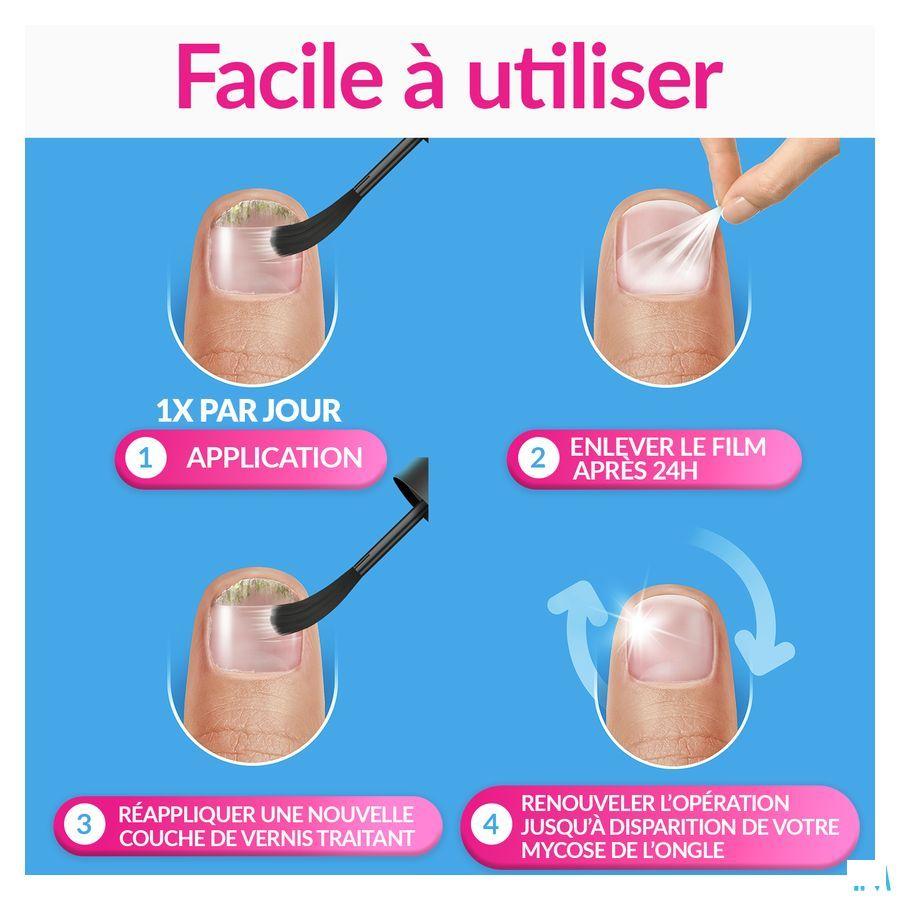 Excilor Forte Schimmelnagels 30 ml