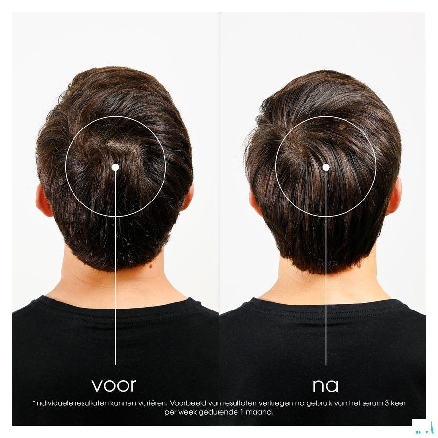 Klorane Capilaire Serum Quinine 100 ml