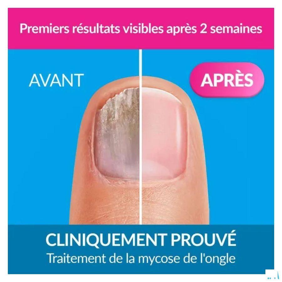 Excilor Liquid 3,3 ml